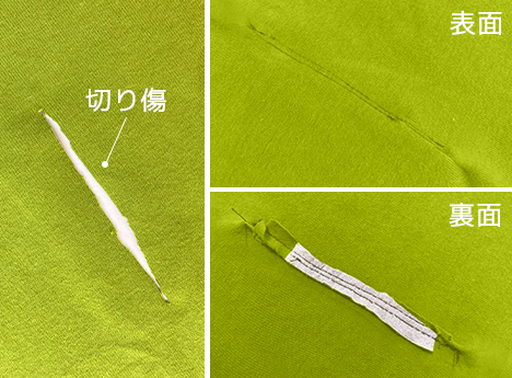 切り傷ビフォーアフター